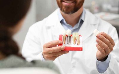 6 Benefits of Dental Implants