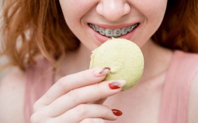 17 Foods to Avoid if You Have Braces